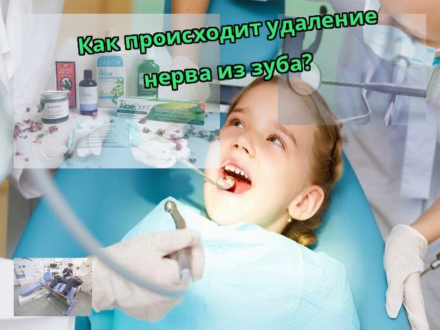 Как происходит удаление нерва из зуба?