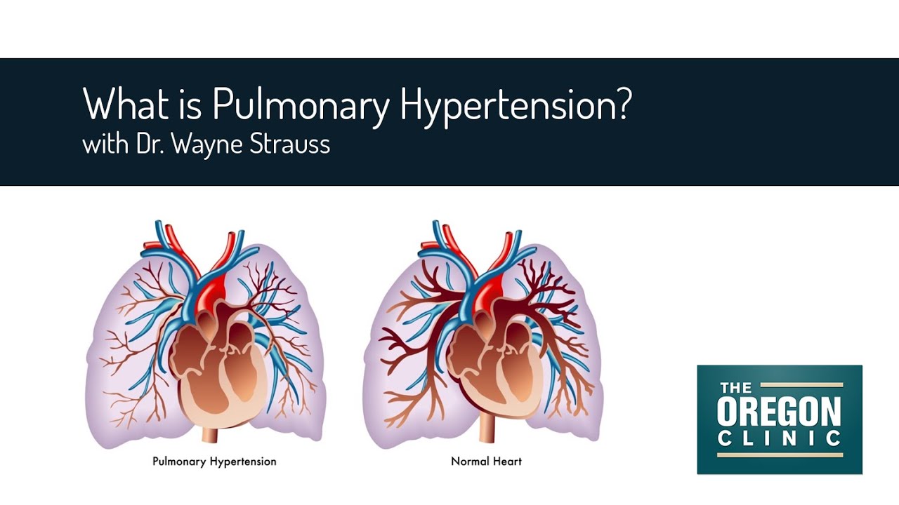 What Is Pulmonary Hypertension YouTube what-is-pulmonary-hypertension-youtube