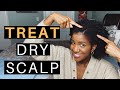 Natural Hair Care Tips On How To Stop Dry Itchy Scalp