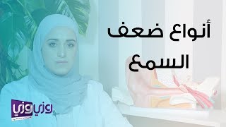 أنواع ضعف السمع