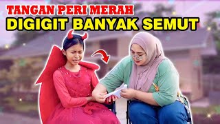 Download lagu THE RED FAIRY'S HAND WAS BITED BY MANY ANTS