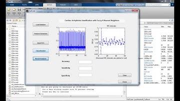 Cardiac Arrhythmia Matlab Code