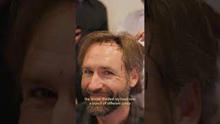a new head of hair #hairtransplant #hairtransformation #hairloss #turkeyhairtransplant #istanbul