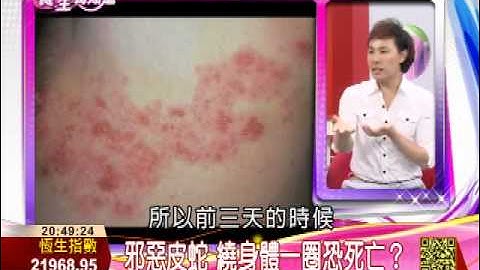 热出一身病7-5：邪恶皮蛇　绕身体一圈恐死亡？ | 养生我知道 | 三立财经台CH88 - 天天要闻