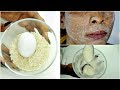 RICE AND EGG FOR INSTANT FACE LIFT, GET RID OF WRINKLES SAGGING SKIN, ANTI - AGING |Khichi Be