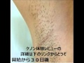 ケノンを実践した経過と効果【７０日間の記録】