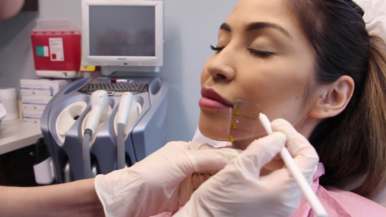Banner for Ulthera Ultrasound Treatment to Reduce Sagging Skin on the Neck by Dr. Boen