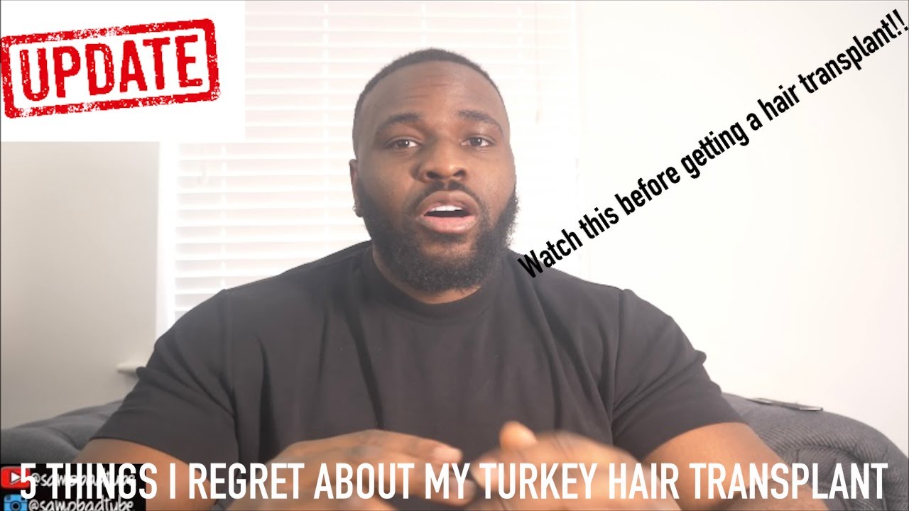 5 THINGS I REGRET ABOUT MY TURKEY HAIR TRANSPLANT/4 MONTHS HAIR UPDATE. *watch before ur transplant*