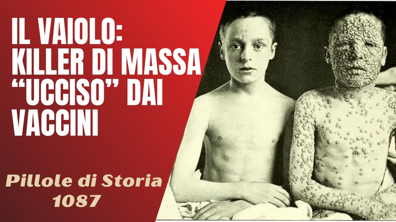 1087- Il vaiolo : killer di massa 