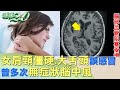 女肩頸僵硬.大舌頭誤感冒 曾多次無症狀腦中風 健康2.0