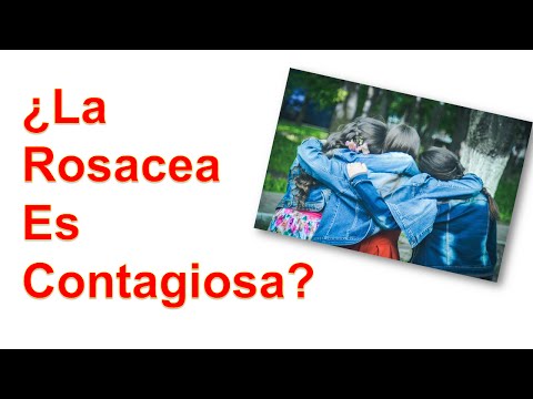 Vídeo: ¿La Rosácea Es Contagiosa? Preguntas Que Podría Tener Miedo De Hacer