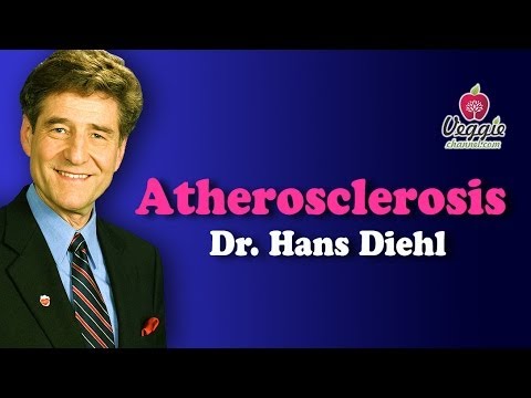 Atherosclerosis - Dr. Hans Diehl - YouTube
