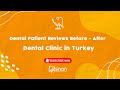 Dental patient reviews before after  dental clinic in turkey