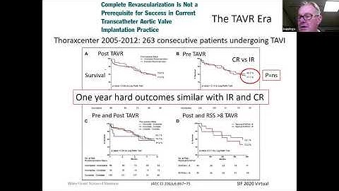 Coronary Revascularization Pre-TAVR: Why, Who and When?