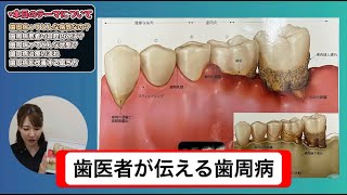 患者さんのエイジングに備える高齢者への歯周治療と口腔管理