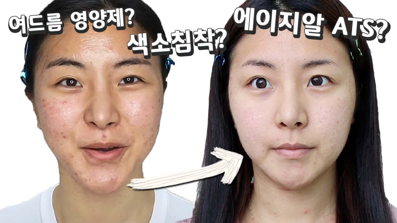 YouTube thumbnail, 뷰드름 유튜버 인씨