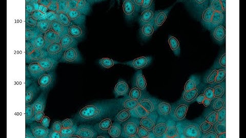 Measuring Nuclear/Cytoplasmic Intensity with CellProfiler