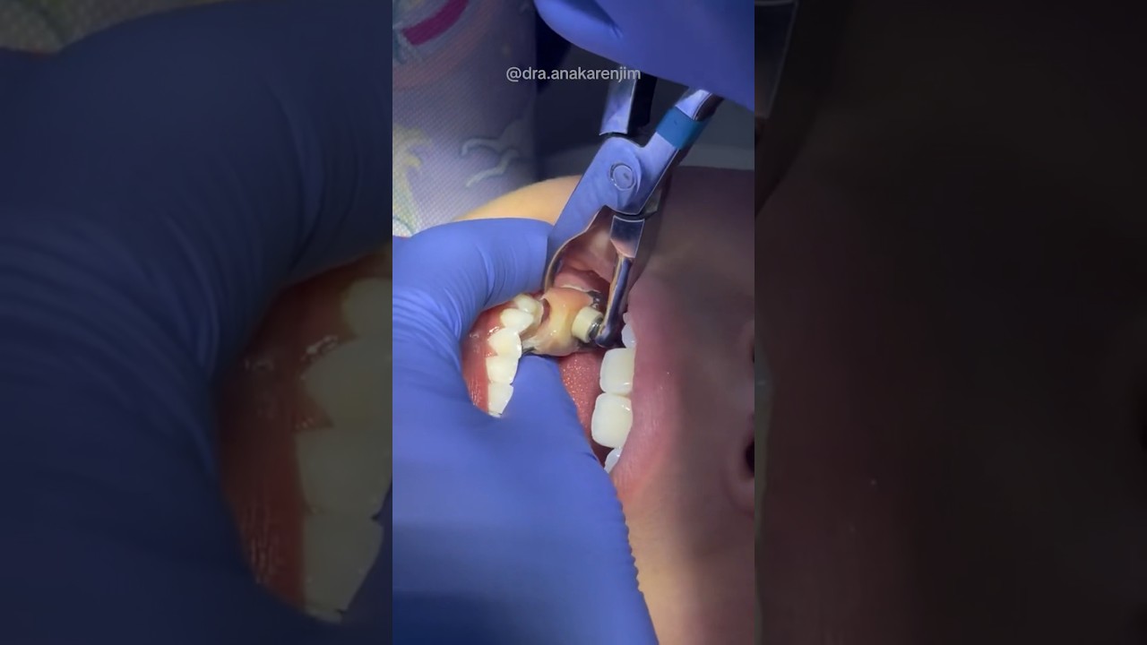 What Is In His Mouth?!