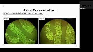 Case based topic review   MGRS