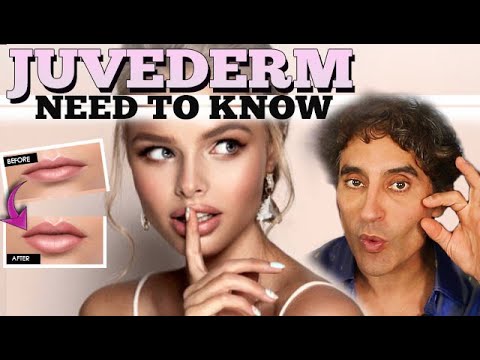 Video: Vil juvederm hjælpe jowls?