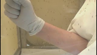 West Nile virus found in Indiana mosquitoes Mosquitoes Indiana