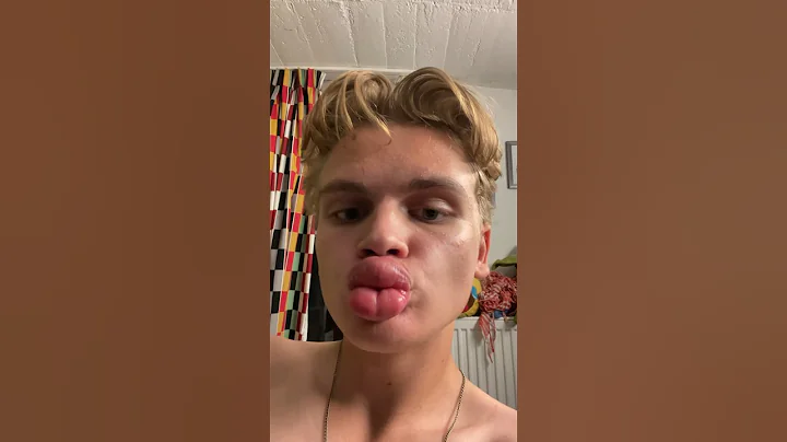 kylie jenner lip challenge 😍 wow very big