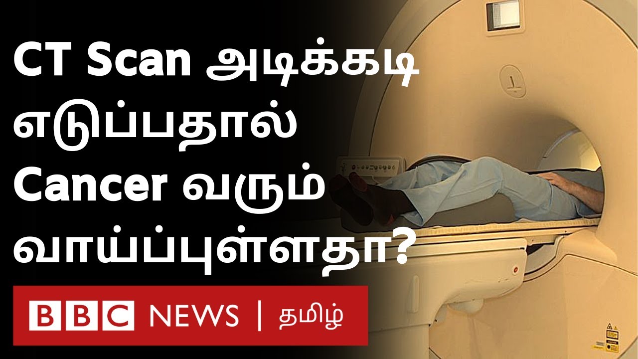Covid19-க்கு CT Scan எடுத்தால் ஆபத்து? AIIMS Director சொல்வது நிஜமா? Doctors கருத்து