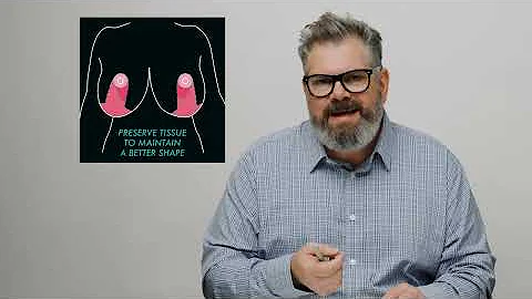 How Many Cup Sizes Can You Drop with Breast Reduction?  | BTM5 Ep.18 #drwilliam