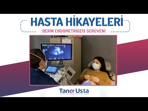 Derin Endometriozis Serüveni 7.6 cm Çikolata Kisti Tedavisi