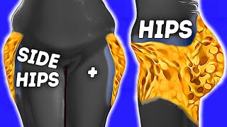 LOSE HIP FAT FAST | BURN HIP FAT AT HOME