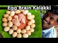 முட்டைல மூளை கலக்கி இப்படி செஞ்சா சூப்பரா இருக்கும் | Egg brain Kalakki | Lamb Brain Kalaki