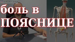 Боль в пояснице что делать