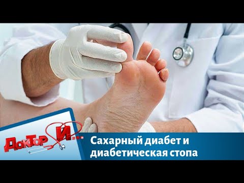 Сахарный диабет и диабетическая стопа | Доктор И