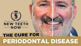 Cure for Periodontal Disease