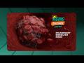 Pulmonary Embolisms: Risks, Warning Signs and How to Lower Your Chances