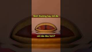 Sự thật ít ai biết về nỗi đau sinh thường và sinh mổ