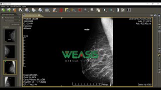 Weasis for Dcm4chee Mac OS