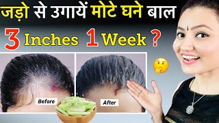 30 Days Extreme Hair Growth Challenge : बेजान Bald पड़ चुकी जड़ो से भी होगी कमाल की  Hair Growth❤️