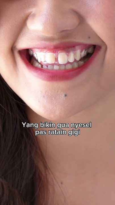 Masih gak percaya aligner bisa ratain gigi lebih cepat dari behel? Cek profil @rata.id