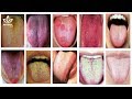 Tongue Sticking Out Meaning - YouTube