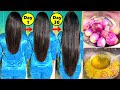 30 Days Challenge - Increase Extreme Hair Growth | Onion For Faster Hair Growth