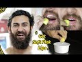 Get Rid of Dark Lips | Get Soft Pink Lips at Home Naturally