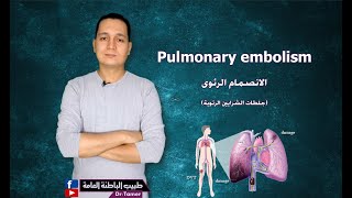 Pulmonary embolism / جلطات الشرايين الرئوية (الانصمام الرئوى)