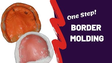 One-Step Border Molding Technique | PROSTHODONTICS