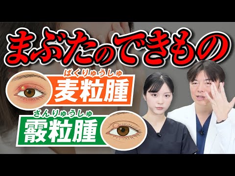 まぶたのできもの|麦粒腫と霰粒腫の違いと治療法