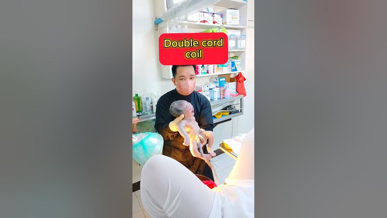 Normal birth with Double cord coil YouTube