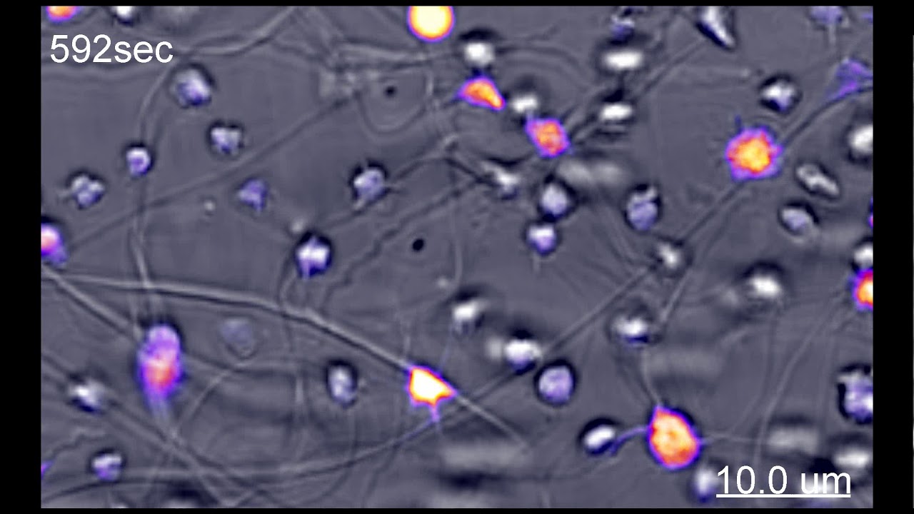 Platelets generate bio-mechanical forces that bend and twist collagen fibers