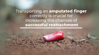 Transporting an amputated finger