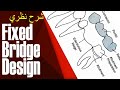 Fixed Bridge Design نظري