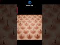 New Molecule May Reactivate Dormant Hair Follicles.mp4